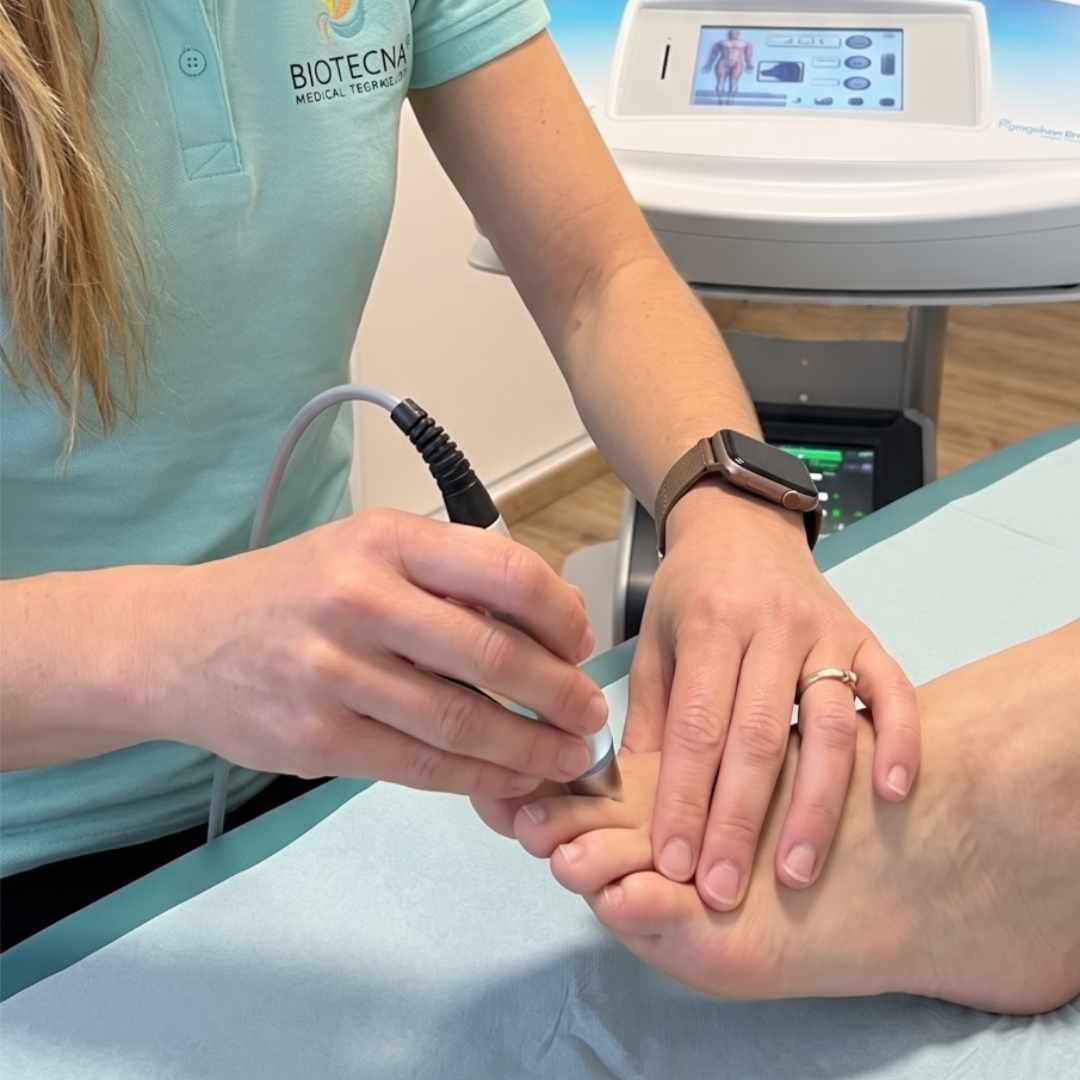 Neuroma de Mortón